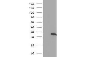 Western Blotting (WB) image for anti-Hes Family bHLH Transcription Factor 1 (HES1) antibody (ABIN1498636) (HES1 Antikörper)