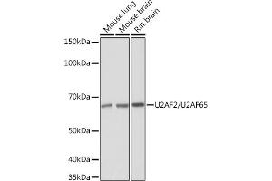 Western blot analysis of extracts of various cell lines, using U2/U2/U2 Rabbit mAb (ABIN1682786, ABIN3019042, ABIN3019043 and ABIN7101704) at 1:1000 dilution.