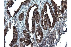 Immunohistochemistry (IHC) image for anti-Programmed Cell Death 6 Interacting Protein (PDCD6IP) antibody (ABIN2715937)