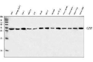 Western blot analysis of C1orf77/FOP/CHTOP using anti-C1orf77/FOP/CHTOP antibody (ABIN7603201). (CHTOP Antikörper  (N-Term))