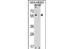 Western blot analysis of TOX3 Antibody (Center) Pab (ABIN651009 and ABIN2840037) pre-incubated without(lane 1) and with(lane 2) blocking peptide in MDA-M cell line lysate. (TOX3 Antikörper  (AA 214-242))