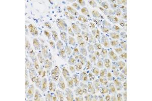 Immunohistochemistry of paraffin-embedded mouse stomach using IFNL1 antibody at dilution of 1:100 (40x lens). (IL29 Antikörper)