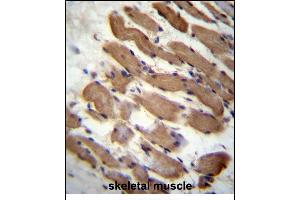 LMD Antibody (N-term) (ABIN657125 and ABIN2846269) immunohistochemistry analysis in formalin fixed and raffin embedded human skeletal muscle followed by peroxidase conjugation of the secondary antibody and DAB staining. (PALMD Antikörper  (N-Term))