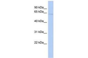 Image no. 1 for anti-Solute Carrier Family 39 (Zinc Transporter), Member 4 (SLC39A4) (AA 359-408) antibody (ABIN6743222) (SLC39A4 Antikörper  (AA 359-408))