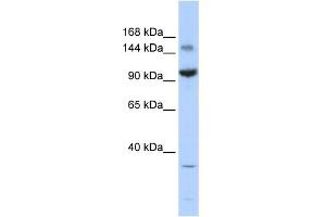 WB Suggested Anti-ZBTB40 Antibody Titration:  0.