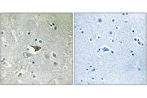 Immunohistochemistry analysis of paraffin-embedded human brain tissue, using CCR5 (Ab-336) Antibody.