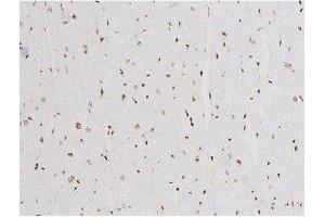 Immunohistochemistry (IHC) image for anti-Spleen tyrosine Kinase (SYK) (pTyr525) antibody (ABIN6255944)