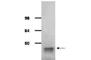 Image no. 1 for anti-Aldolase A, Fructose-Bisphosphate (ALDOA) antibody (ABIN799723) (ALDOA Antikörper)