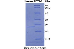SDS-PAGE analysis of Human CPT1A Protein.