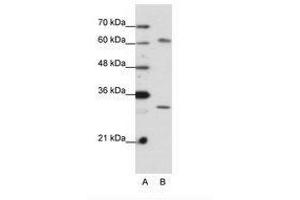 Image no. 2 for anti-AU RNA Binding Protein/enoyl-CoA Hydratase (AUH) (AA 228-277) antibody (ABIN6736199) (AUH Antikörper  (AA 228-277))