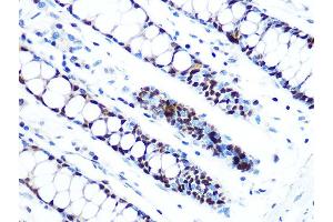 Immunohistochemistry of paraffin-embedded human colon using MCM5 Rabbit mAb (ABIN7268543) at dilution of 1:100 (40x lens). (MCM5 Antikörper)