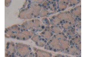 Immunohistochemistry (IHC) image for anti-serpin Peptidase Inhibitor, Clade B (Ovalbumin), Member 1 (SERPINB1) (AA 17-332) antibody (ABIN7443074)
