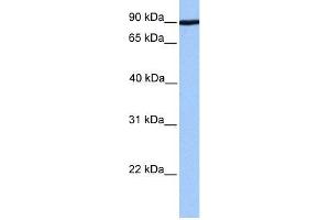 Human 721_B; WB Suggested Anti-ADAM2 Antibody Titration: 0. (ADAM2 Antikörper  (Middle Region))