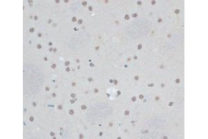 Immunohistochemistry of paraffin-embedded Rat brain using ZNF433 Polyclonal Antibody at dilution of 1:100 (40x lens).
