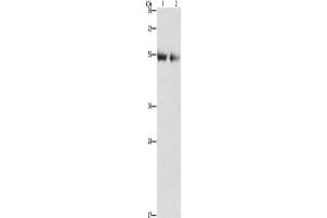 Western Blotting (WB) image for anti-Angiopoietin 4 (ANGPT4) antibody (ABIN2432478) (Angiopoietin 4 Antikörper)