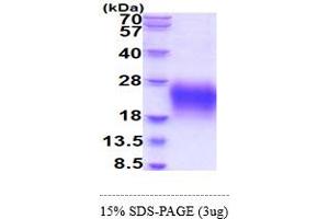 SDS-PAGE (SDS) image for B-cell antigen receptor complex-associated protein alpha chain (CD79A) (AA 33-143) protein (His tag) (ABIN5854979) (CD79a Protein (AA 33-143) (His tag))