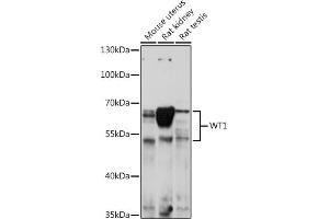 Western blot analysis of extracts of various cell lines, using WT1 antibody (ABIN7271369) at 1:1000 dilution. (WT1 Antikörper  (AA 1-302))