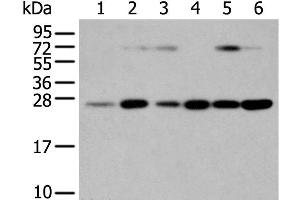 Western Blot analysis of Human placenta tissue and hela cell, hepg2 cell and Human fetal liver tissue, A549 cell and Human normal kidney tissue using SNAP23 Polyclonal Antibody at dilution of 1:400 (SNAP23 Antikörper)