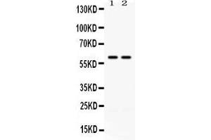 Western blot analysis of CCT3 using anti- CCT3 antibody .