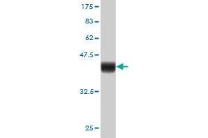 Western Blot detection against Immunogen (36. (FOXM1 Antikörper  (AA 702-801))