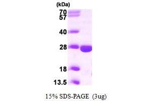 SDS-PAGE (SDS) image for phosphopantothenoylcysteine Decarboxylase (PPCDC) (AA 1-204) protein (His tag) (ABIN667238) (PPCDC Protein (AA 1-204) (His tag))
