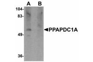 Image no. 1 for anti-Phosphatidic Acid Phosphatase Type 2 Domain Containing 1A (PPAPDC1A) (C-Term) antibody (ABIN478207) (PPAPDC1A Antikörper  (C-Term))