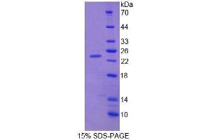 SDS-PAGE (SDS) image for Cerebral Dopamine Neurotrophic Factor (CDNF) (AA 20-183) protein (His tag) (ABIN1098941) (CDNF Protein (AA 20-183) (His tag))