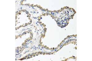 Immunohistochemistry of paraffin-embedded human prostate using COLEC11 antibody at dilution of 1:100 (40x lens).