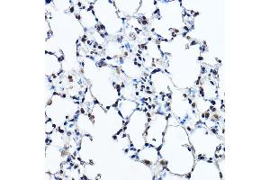 Immunohistochemistry (IHC) image for anti-Twist Homolog 1 (Drosophila) (TWIST1) (AA 1-100) antibody (ABIN6149713)