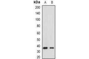 Western blot analysis of HLA-DRA expression in Raji (A), Jurkat (B) whole cell lysates. (HLA-DRA Antikörper)