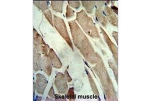 Formalin-fixed and paraffin-embedded human skeletal muscle reacted with the primary antibody, which was peroxidase-conjugated to the secondary antibody, followed by AEC staining.