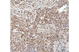IHC analysis of SDE2 using anti-SDE2 antibody (ABIN7599603). (C1orf55 Antikörper  (AA 10-447))