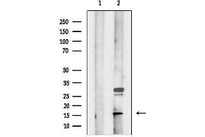 anti-Mitochondrial Ribosomal Protein S18C (MRPS18C) (Internal Region) antibody