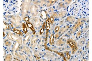 ABIN6259232 and ABIN6275659 at 1/100 staining Rat kidney tissue by IHC-P. (USP45 Antikörper  (Internal Region))