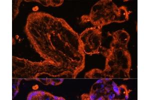 Immunofluorescence (IF) image for anti-LIM Domain Binding 3 (LDB3) antibody (ABIN7263475)