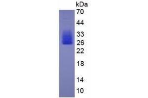 Image no. 1 for Interleukin 6 (IL6) (AA 25-211) (Active) protein (His tag) (ABIN6239753)
