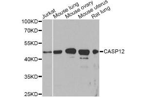 Western blot analysis of extracts of various cell lines, using CASP12 Antibody. (Caspase 12 Antikörper)