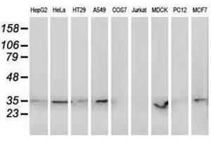 Image no. 2 for anti-Retinol Dehydrogenase 14 (All-Trans/9-Cis/11-Cis) (RDH14) antibody (ABIN1500657) (RDH14 Antikörper)