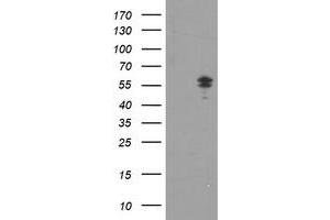 HEK293T cells were transfected with the pCMV6-ENTRY control (Left lane) or pCMV6-ENTRY NONO (Right lane) cDNA for 48 hrs and lysed. (NONO Antikörper  (AA 184-385))
