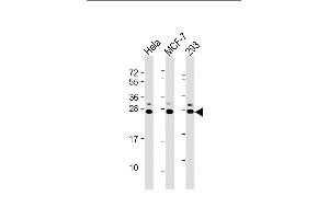 All lanes : Anti-KDELR1 Antibody (C-term) at 1:2000 dilution Lane 1: Hela whole cell lysate Lane 2: MCF-7 whole cell lysate Lane 3: 293 whole cell lysate Lysates/proteins at 20 μg per lane. (KDELR (AA 185-211), (C-Term) Antikörper)