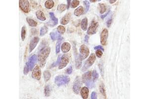 Immunohistochemistry (IHC) image for anti-CoaA (AA 150-200) antibody (ABIN7448480) (CoaA (AA 150-200) Antikörper)
