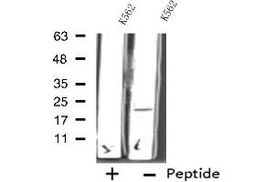 Western blot analysis of extracts from K562 cells using RPL11 antibody. (RPL11 Antikörper  (C-Term))