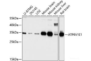 Western blot analysis of extracts of various cell lines using ATP6V1E1 Polyclonal Antibody at dilution of 1:1000. (ATP6V1E1 Antikörper)
