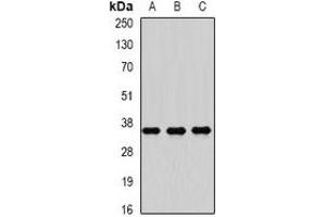 Western blot analysis of RASSF1 expression in Hela (A), HepG2 (B), SW480 (C) whole cell lysates. (RASSF1 Antikörper)