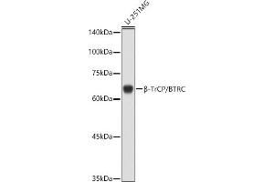 Western Blotting (WB) image for anti-beta-Transducin Repeat Containing (BTRC) (AA 50-340) antibody (ABIN3022334)