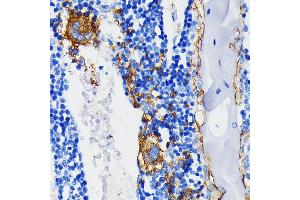 Immunohistochemistry of paraffin-embedded rat bone marrow using Integrin beta 3 (ITGB3/CD61) (ITGB3/CD61) Rabbit mAb (ABIN7267928) at dilution of 1:100 (40x lens).
