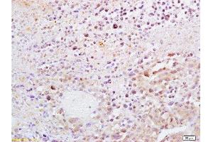 Formalin-fixed and paraffin embedded mouse lymphoma tissue labeled with Anti-Dnmt1 Polyclonal Antibody, Unconjugated  at 1:200, followed by conjugation to the secondary antibody and DAB staining (DNMT1 Antikörper  (AA 21-120))