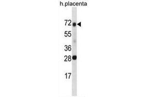 SPINT1 Antibody (Center) western blot analysis in human placenta tissue lysates (35µg/lane). (SPINT1 Antikörper  (Middle Region))