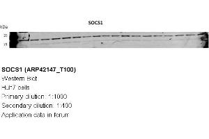 Image no. 3 for anti-Suppressor of Cytokine Signaling 1 (SOCS1) (N-Term) antibody (ABIN310288) (SOCS1 Antikörper  (N-Term))