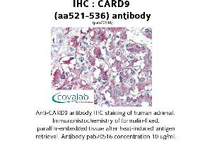 Image no. 1 for anti-Caspase Recruitment Domain Family, Member 9 (CARD9) (AA 521-536) antibody (ABIN1732641) (CARD9 Antikörper  (AA 521-536))